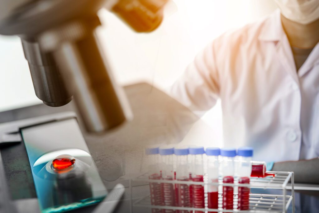 Utilizando o LIMS para simplificar a coleta de resultados em ...
